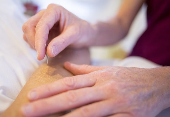 Acupuncture Needle In Skin